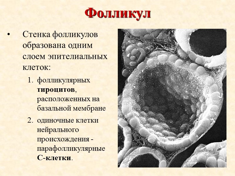 Фолликул Стенка фолликулов образована одним слоем эпителиальных клеток: фолликулярных тироцитов, расположенных на базальной мембране